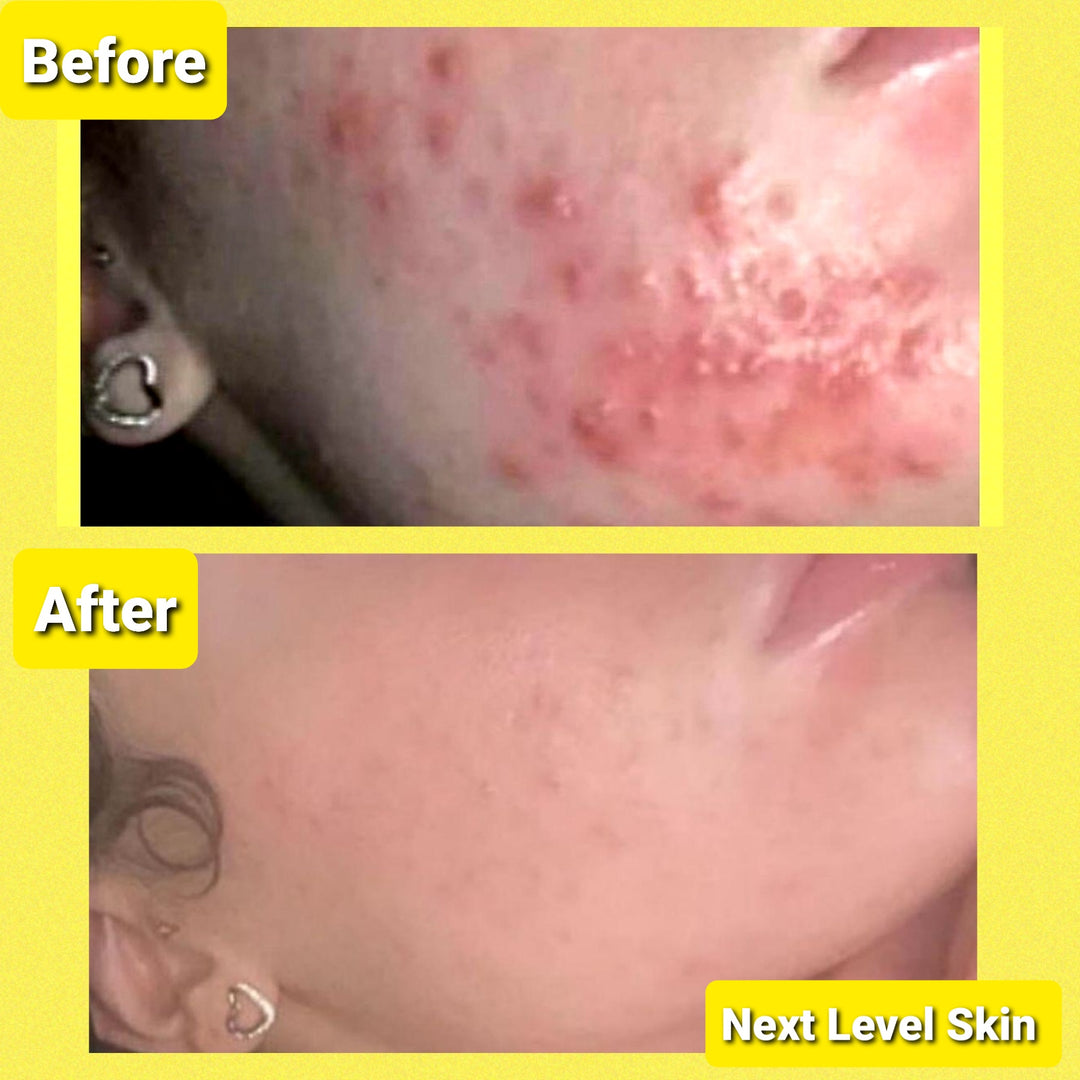 Ultimate Skincare Bundle