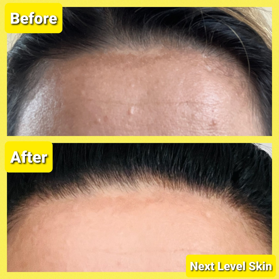 Pigmentation and Wrinkle Bundle