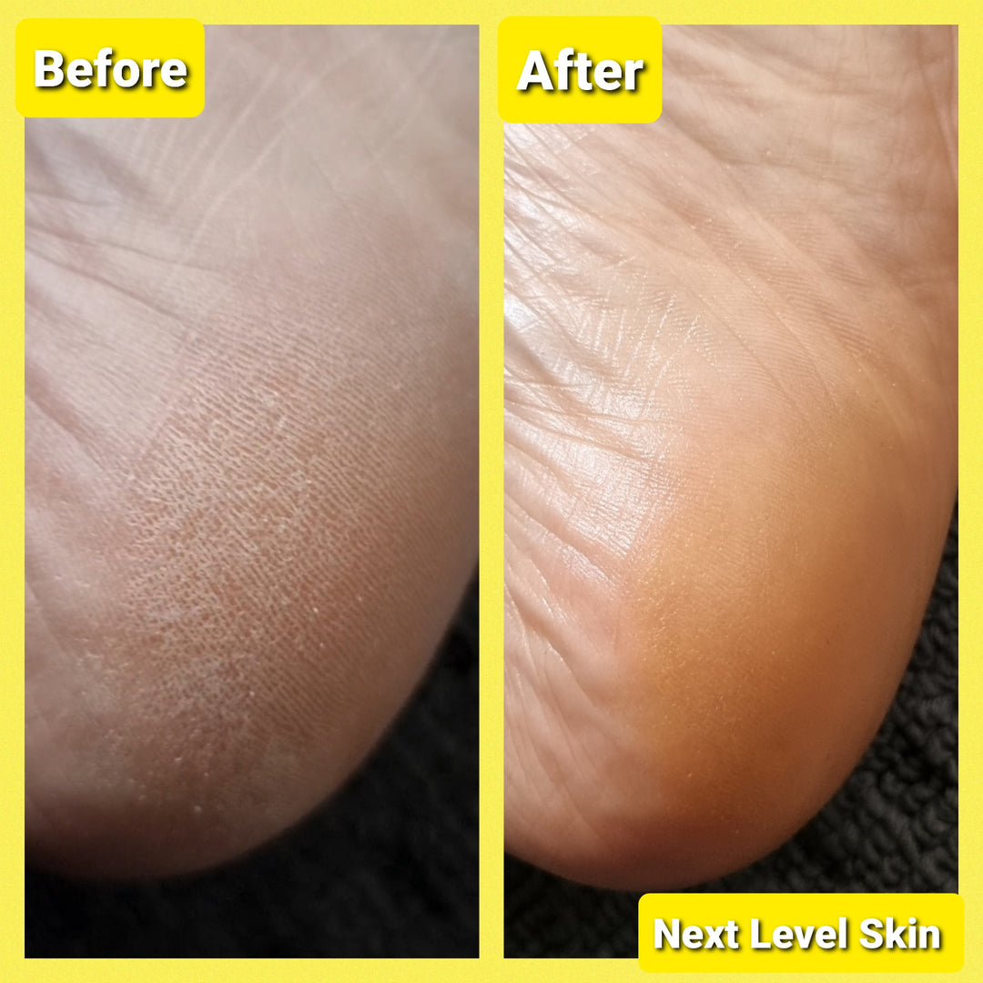 Ultra Healing Balm