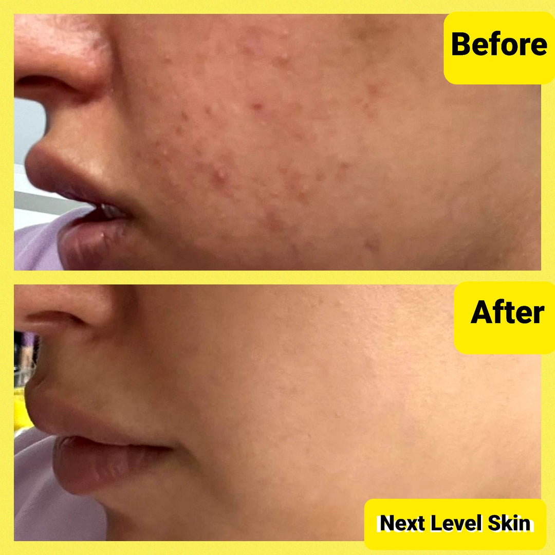 Ultimate Skincare Bundle