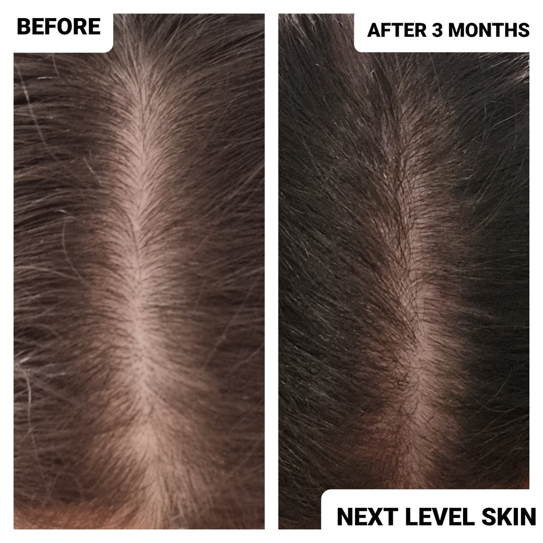SUPERCHARGED HAIR OIL
