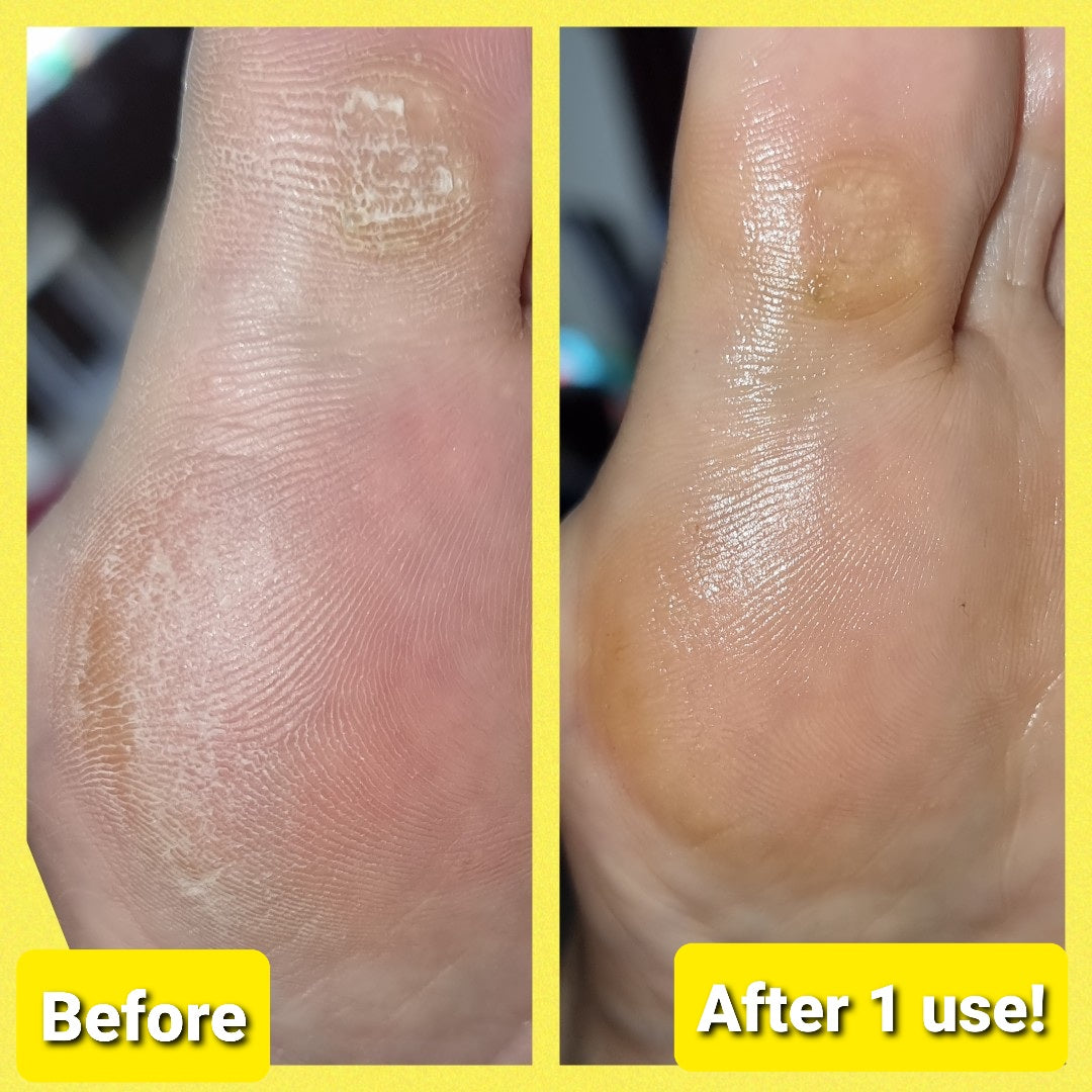 Ultra Healing Balm