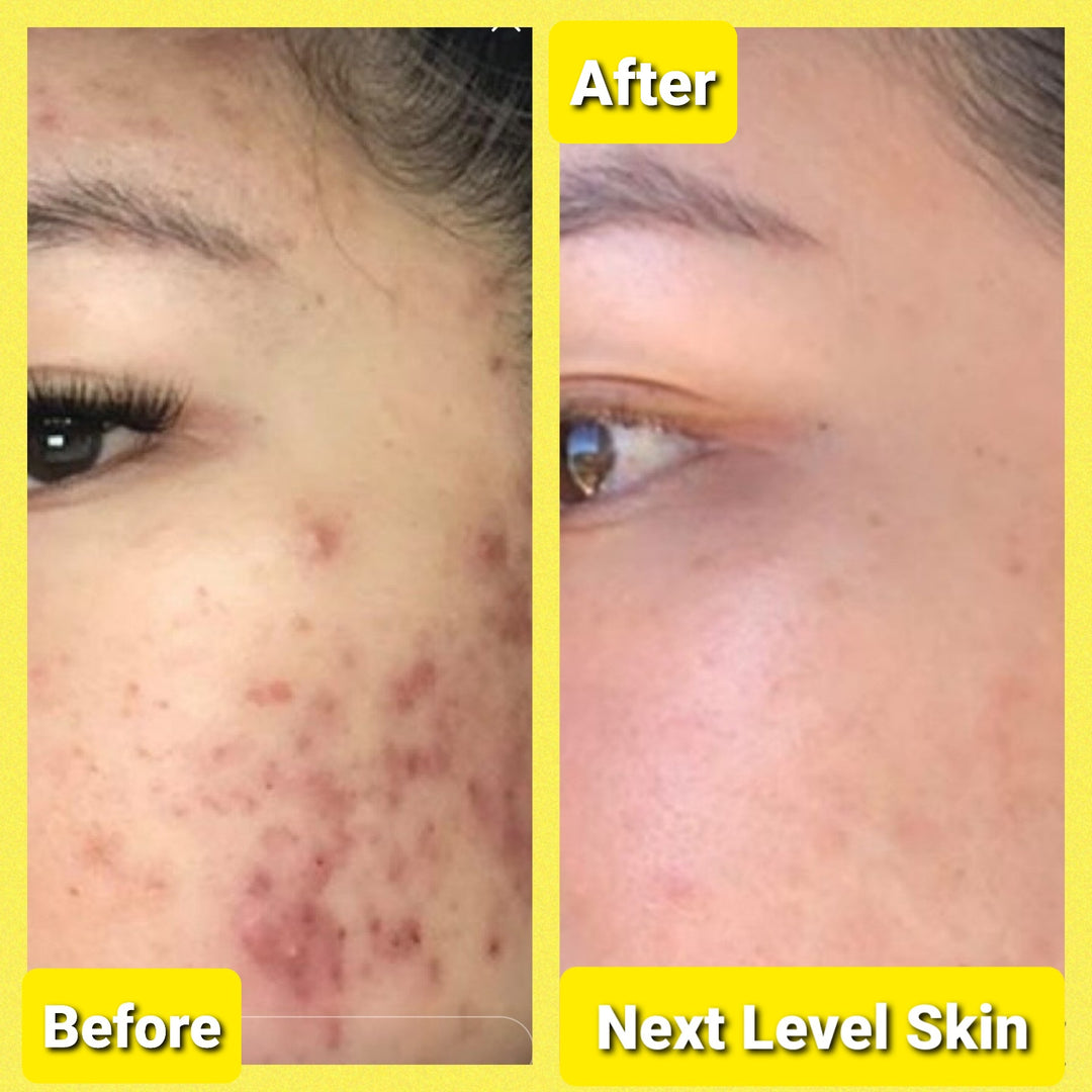 Ultimate Skincare Bundle