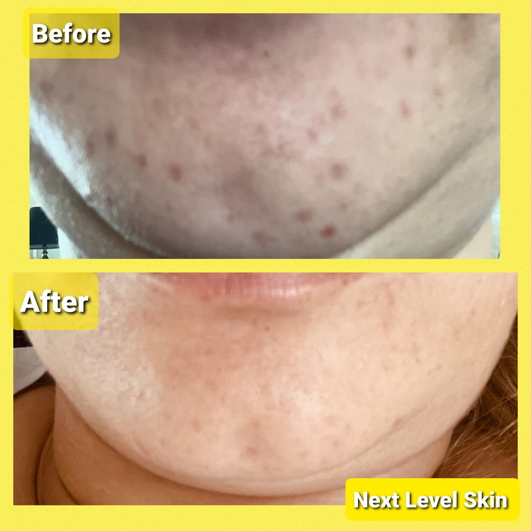 Pigmentation and Wrinkle Bundle