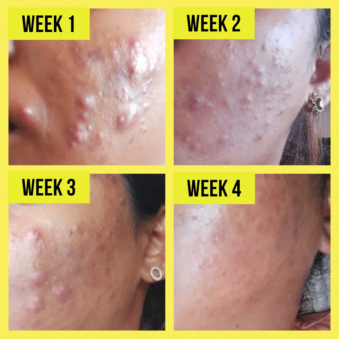Ultimate Skincare Bundle
