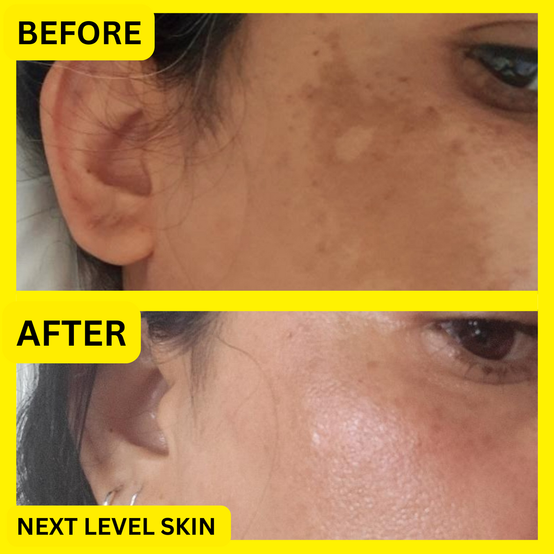 Pigmentation and Wrinkle Bundle