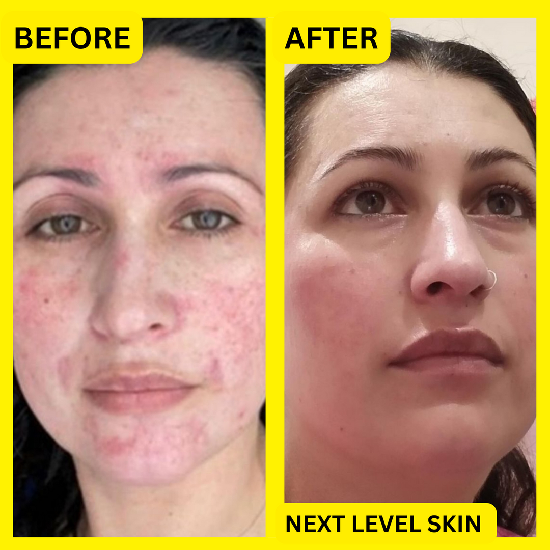 Pigmentation and Wrinkle Bundle